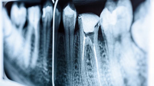 endodonciadental