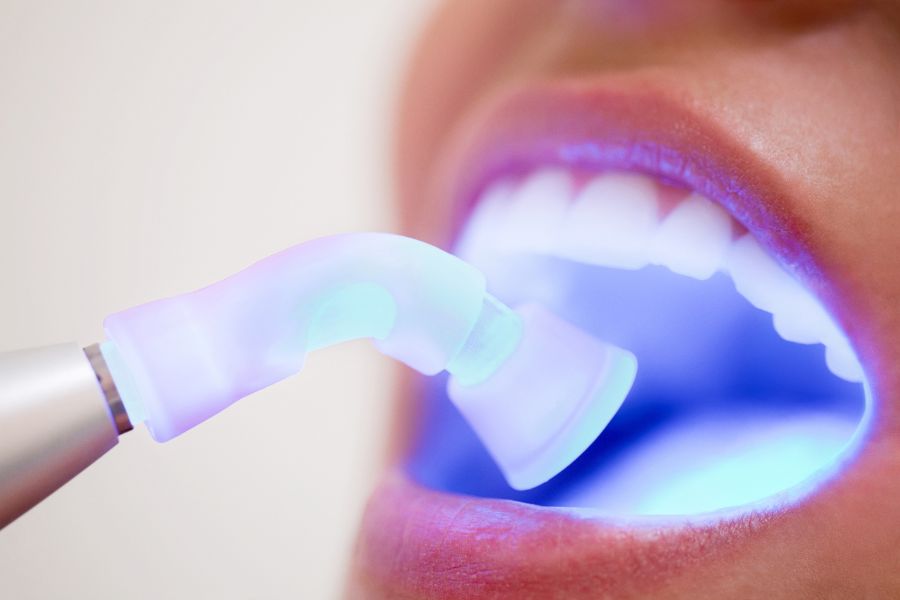 Empaste dental: qué es y cuanto dura